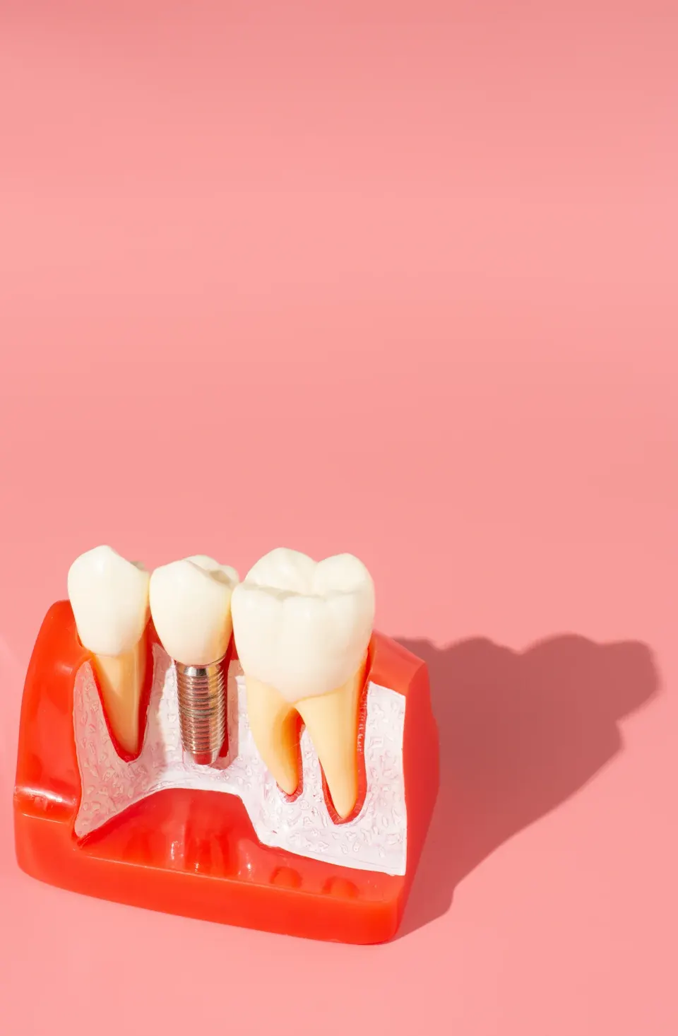 Patient consulting with Dr. Manmode about dental implant benefits at Dental World Longwood