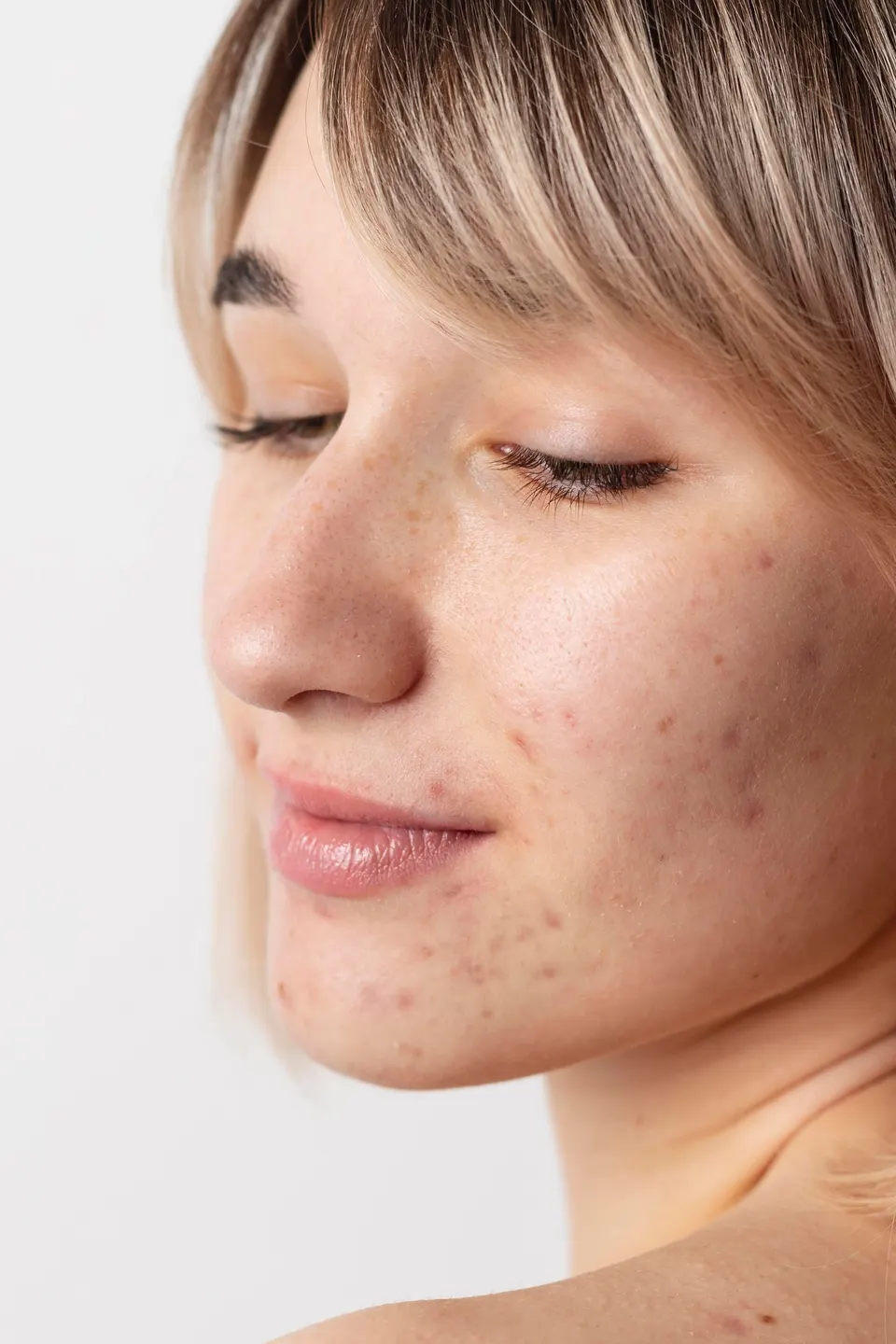 Person concerned about jawline definition at Dental World Longwood FL