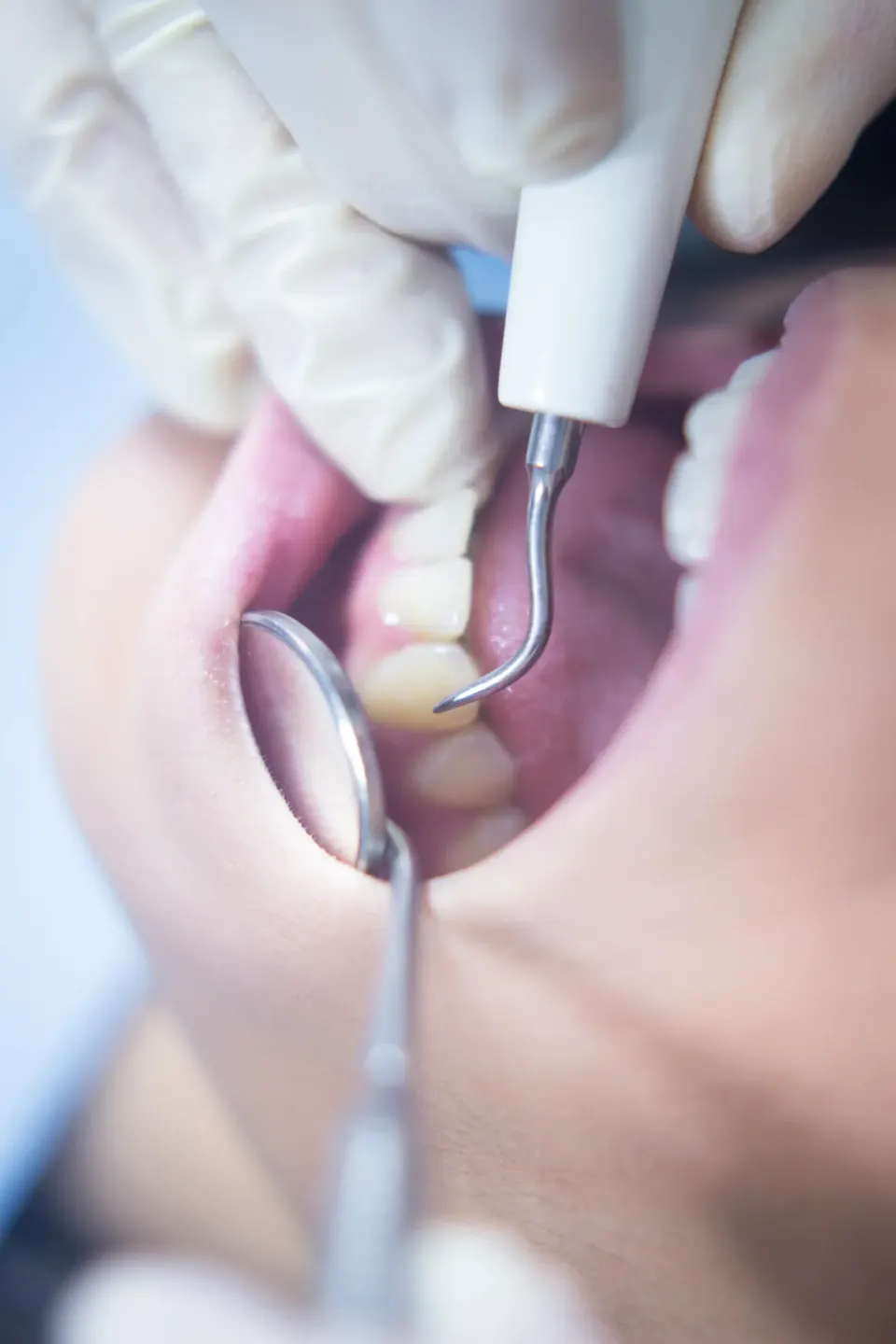 Patient and provider consultation about single tooth implant benefits at Dental World Longwood