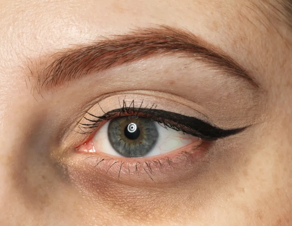 Close-up of periorbital skin showing under-eye shadowing at Dental World Longwood