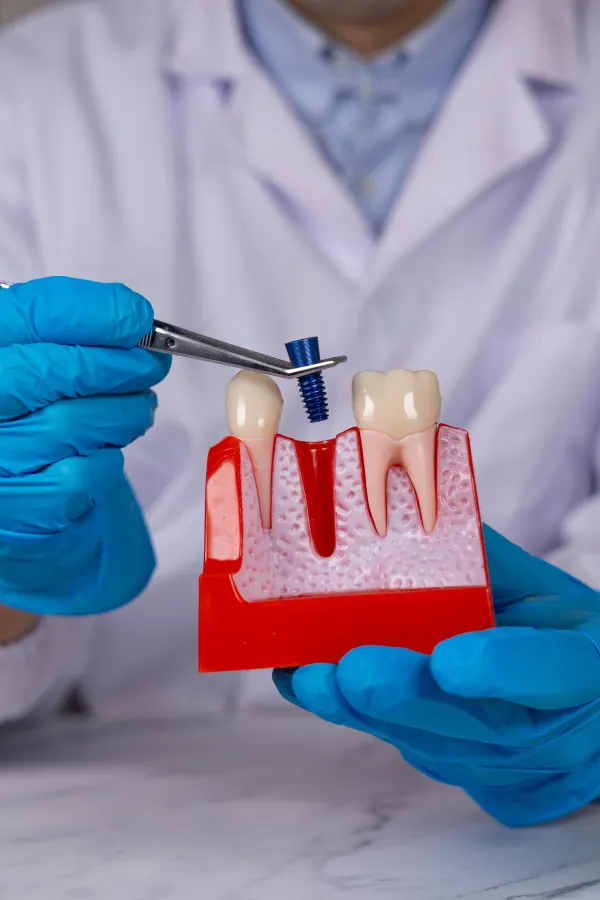 Warning signs of a failing dental implant explained at Dental World in Longwood Florida