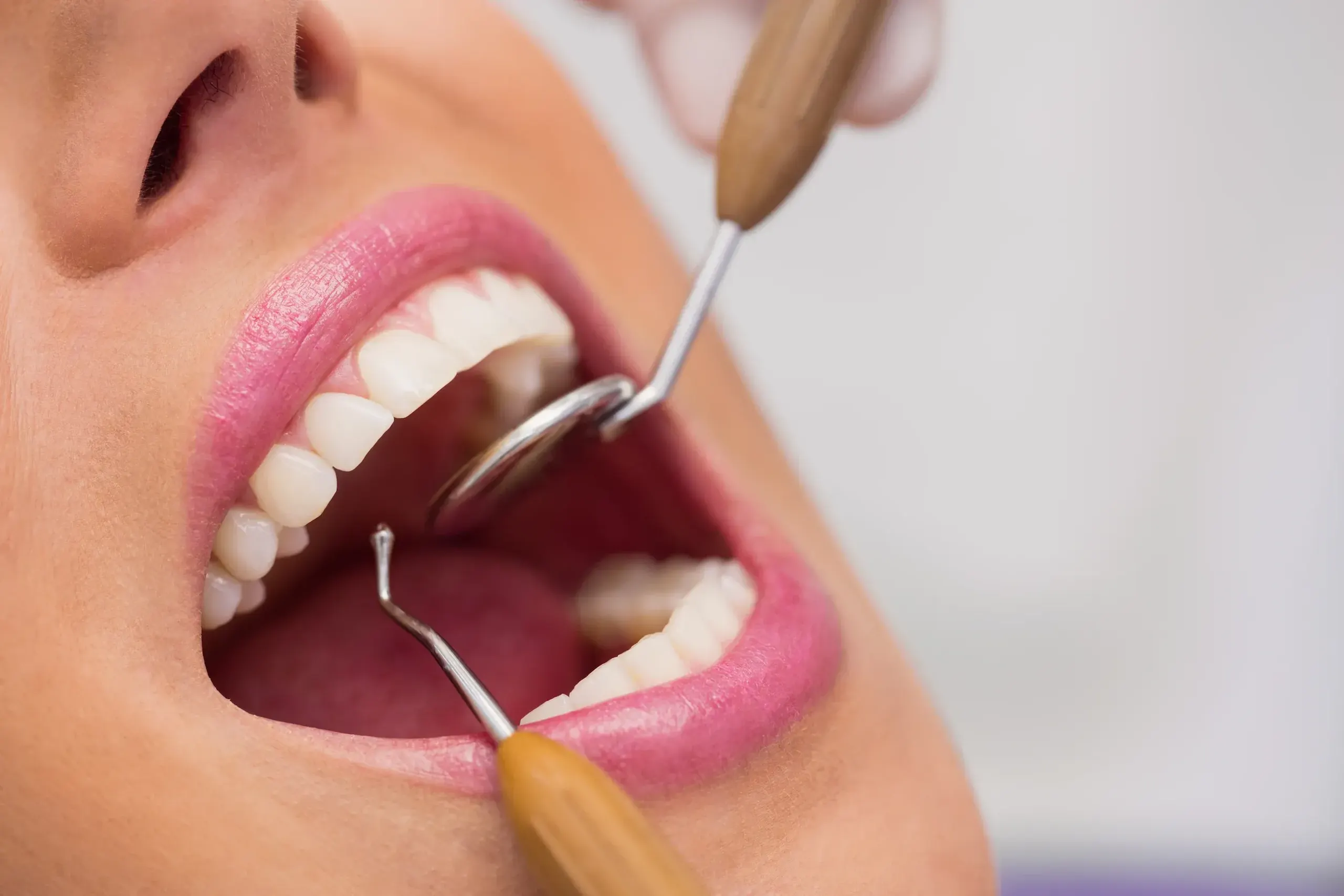 Tooth extraction treatment at Dental World in Longwood FL