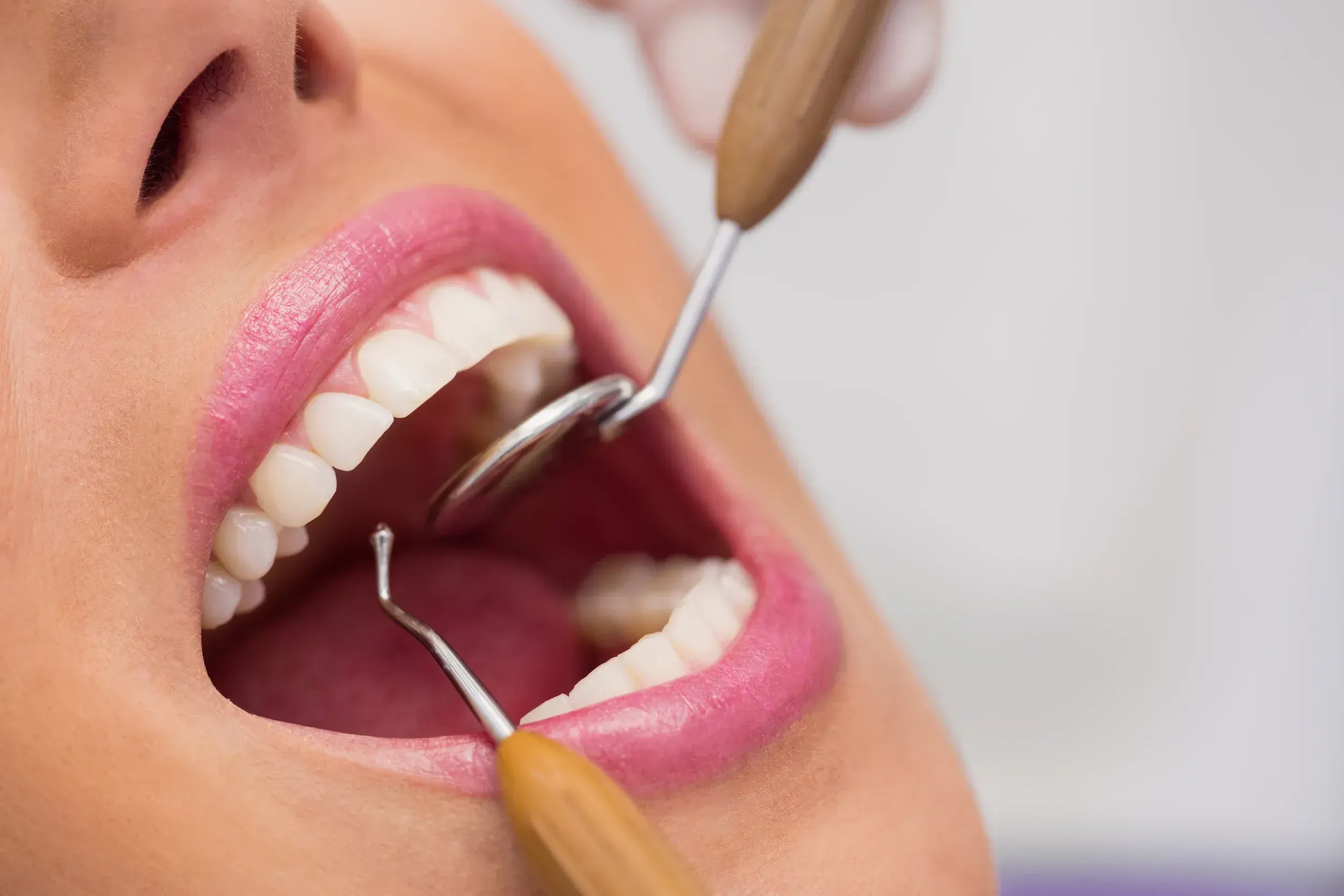 Tooth extraction treatment at Dental World in Longwood FL