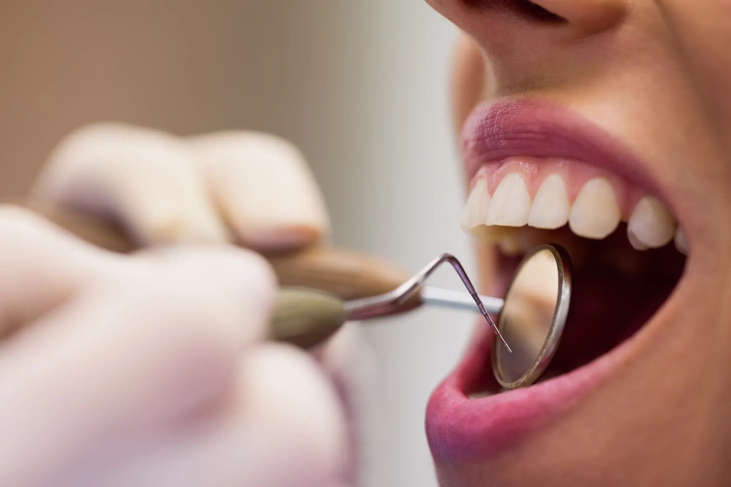 Lifestyle factors affecting tooth loss risk at Dental World Longwood