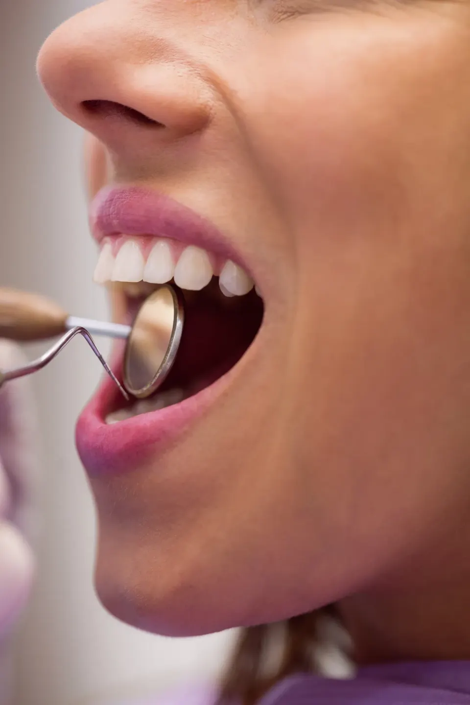 Patient concerned about tooth discoloration consulting at Dental World Longwood