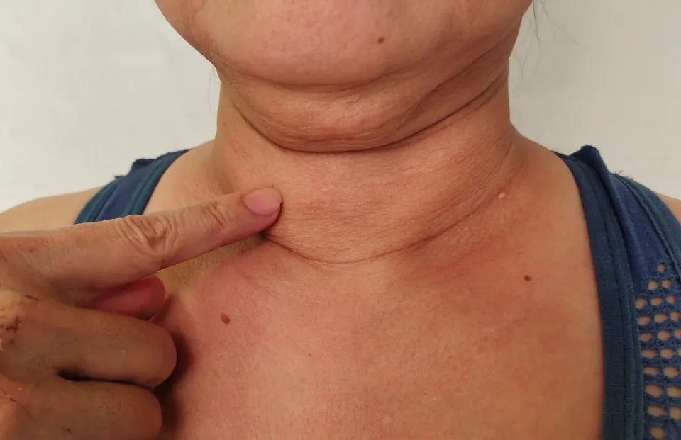 Person examining jawline at Dental World Longwood FL