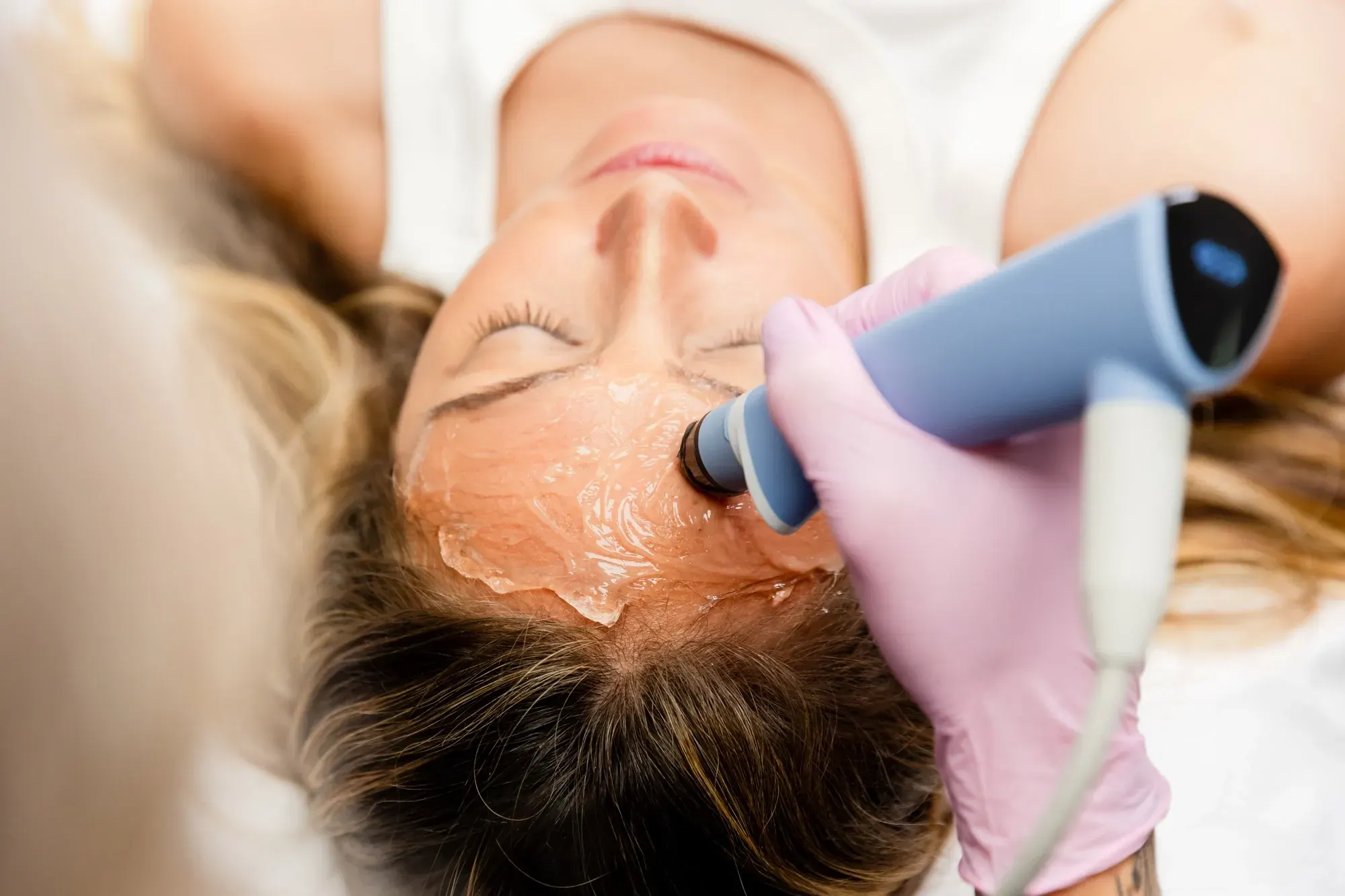 Benefits of Exion Face