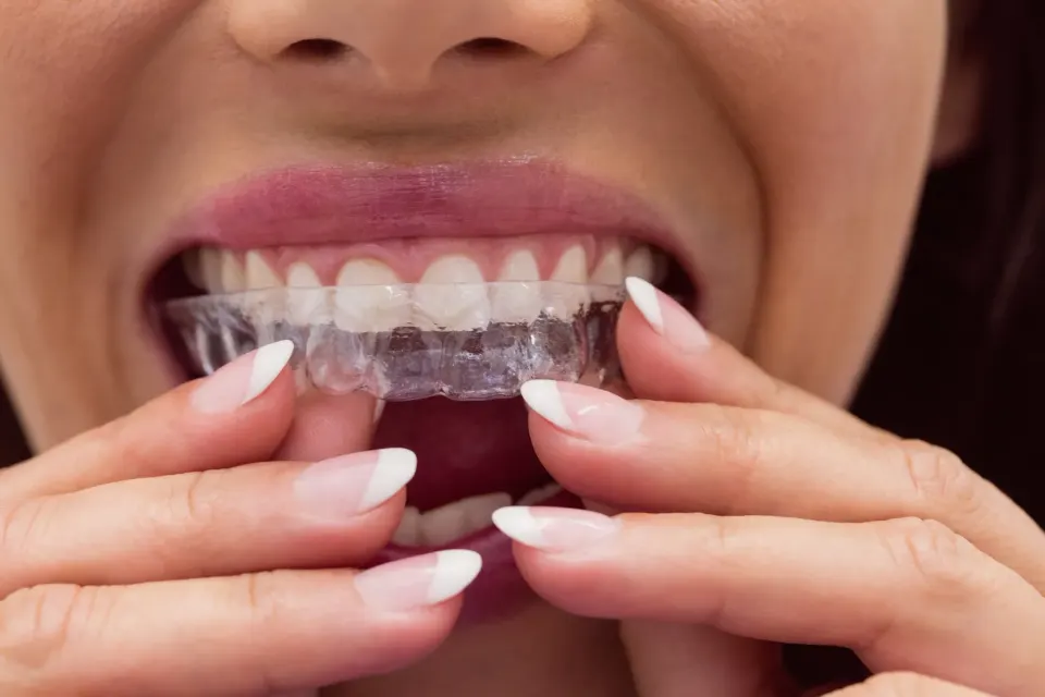 Abstract soft gradient background representing dental alignment and orthodontic care