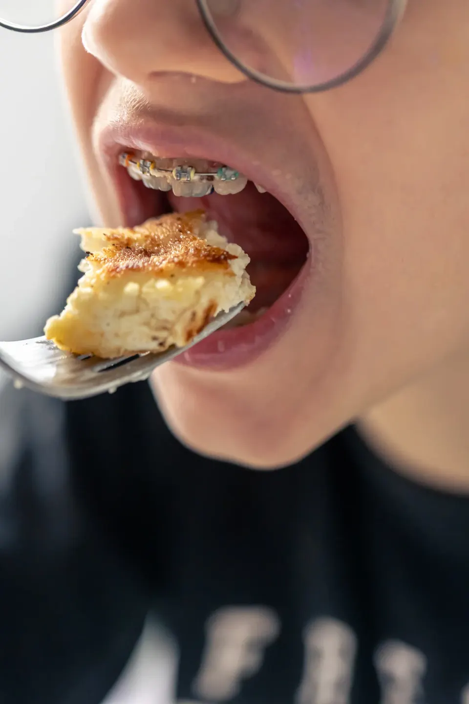 Close-up illustration of tooth decay progression at Dental World Longwood