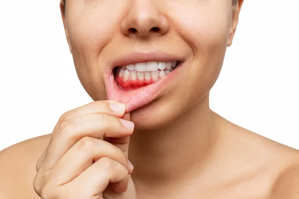 Patient receiving gum evaluation at Dental World Longwood FL