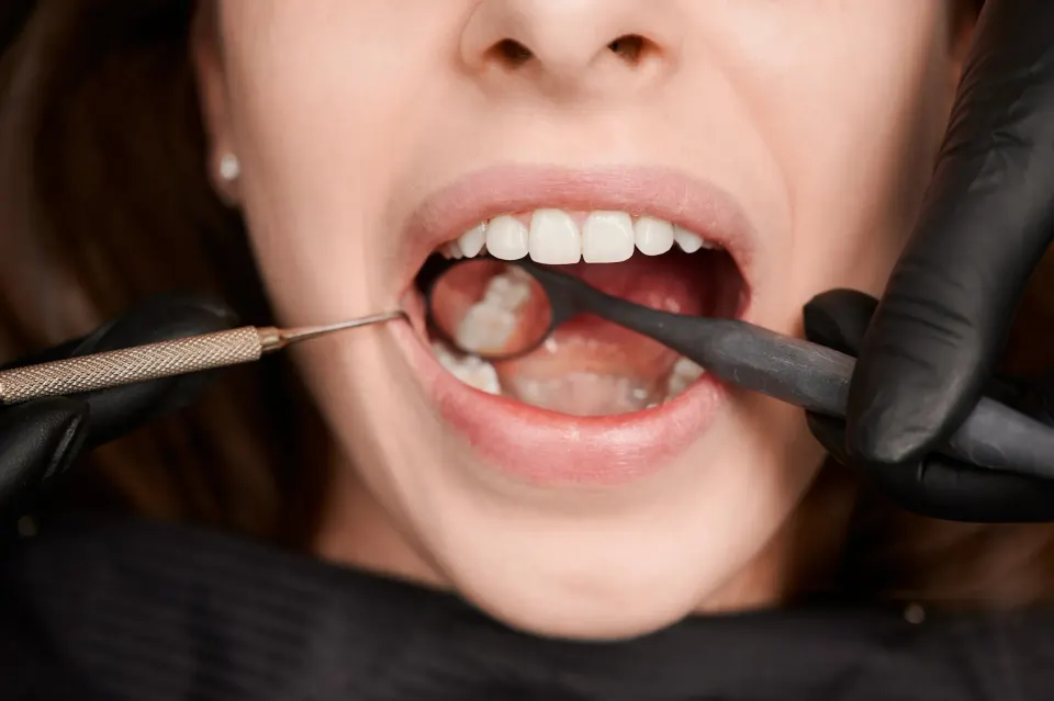 Lifestyle and oral habits affecting gum recession at Dental World Longwood FL