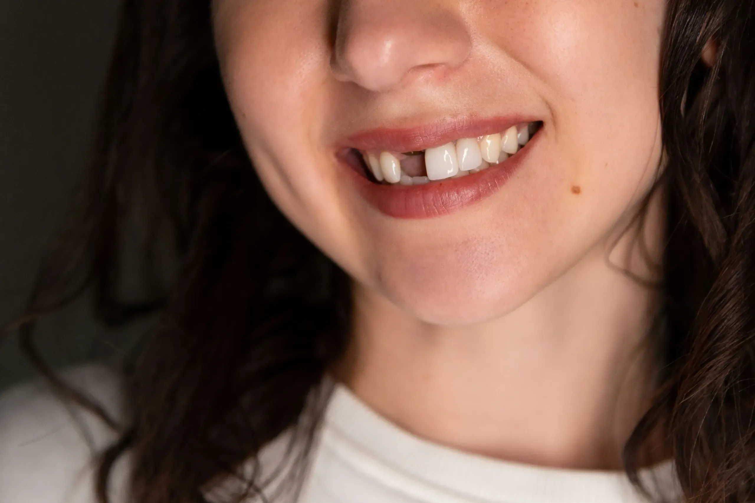 Patient smiling confidently after tooth replacement at Dental World Longwood