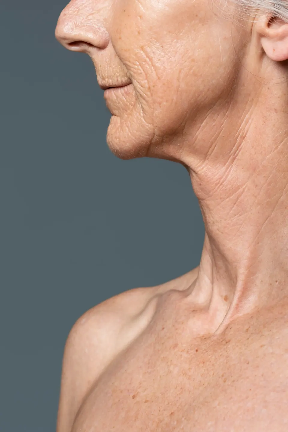 Patient noticing saggy skin along the jawline at Dental World Longwood FL