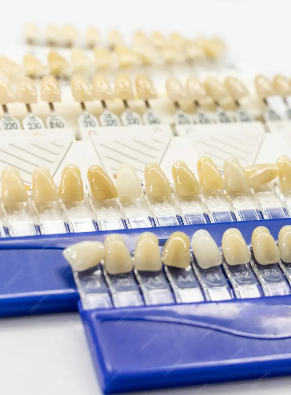Porcelain veneer materials used at Dental World Longwood