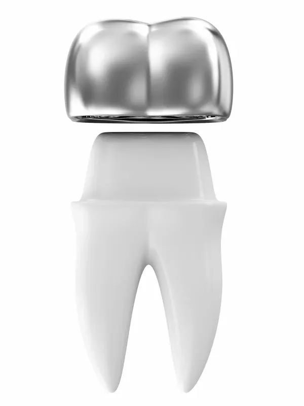 Before and after dental crown results showing restored tooth at Dental World Longwood