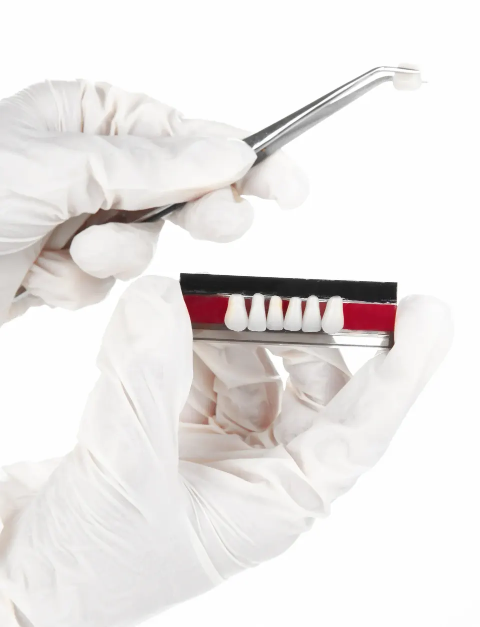 Diagram showing bone resorption after tooth loss at Dental World