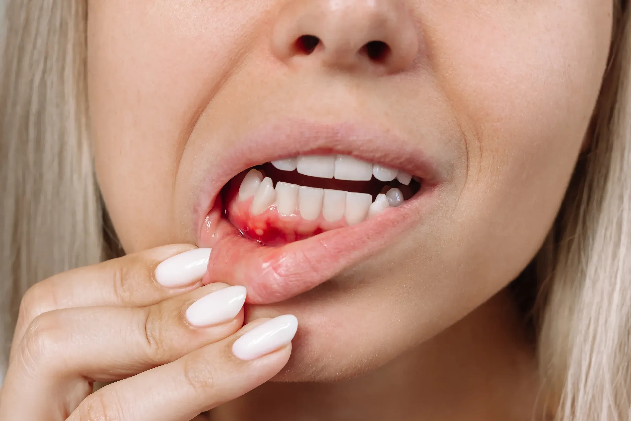 Patient concerned about receding gums at Dental World Longwood Florida