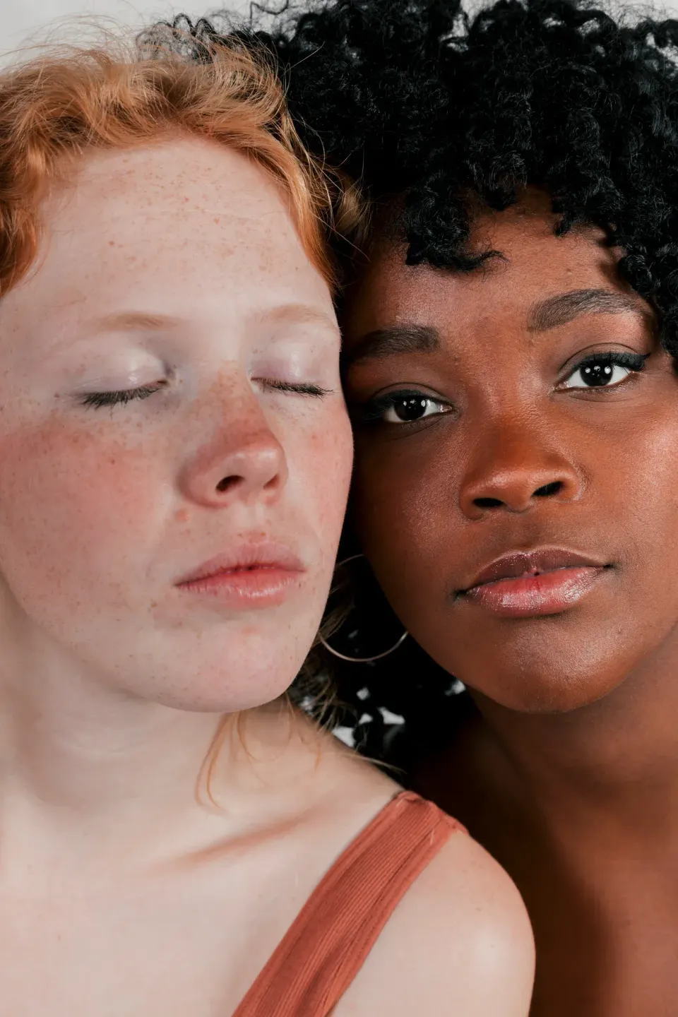 Close-up of uneven skin texture including enlarged pores and acne scarring at Dental World Longwood