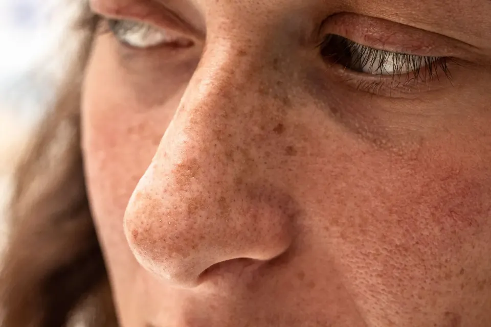 Lifestyle and environmental factors affecting skin texture at Dental World Longwood FL