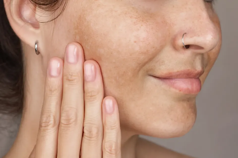 Woman with uneven skin texture seeking facial esthetic care at Dental World Longwood FL