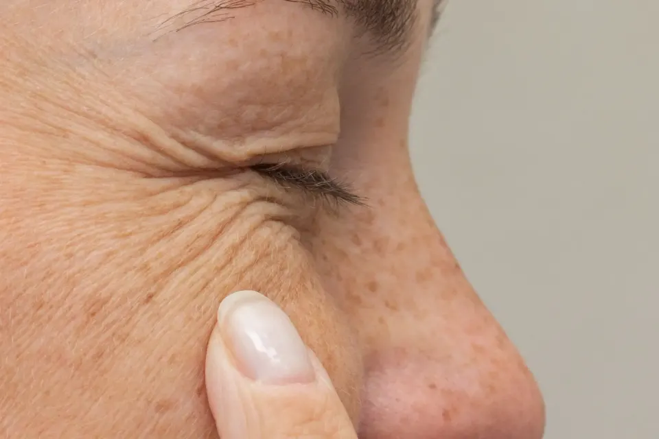 Lifestyle and environmental factors contributing to facial wrinkles at Dental World Longwood FL