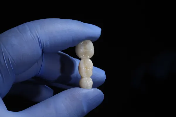 Comparison of white zirconia implant and titanium implant at Dental World in Longwood